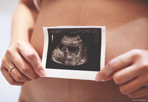 Prvé tehotenstvo po tridsiatke