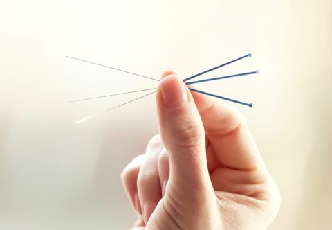 Ako sa z odporkyne ihiel stala zástankyňa akupunktúry