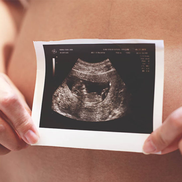 Prvé tehotenstvo po tridsiatke